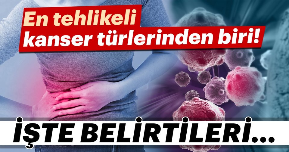 Pankreas Kanserinin Aşamaları Nelerdir